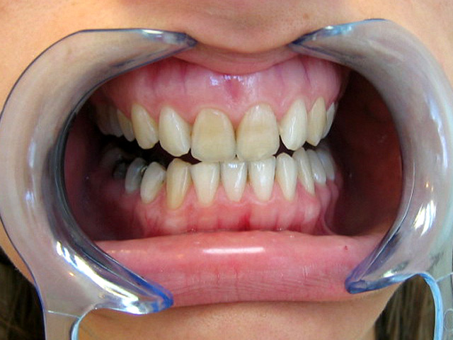 Bez�r�shoz kattintson a k�pre!