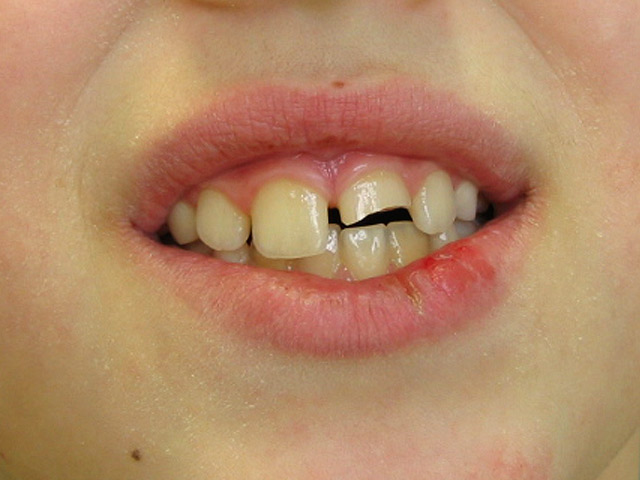 Bez�r�shoz kattintson a k�pre!