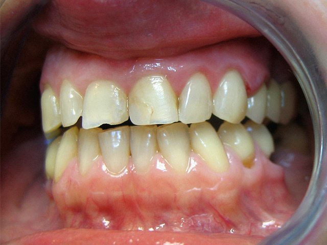 Bez�r�shoz kattintson a k�pre!