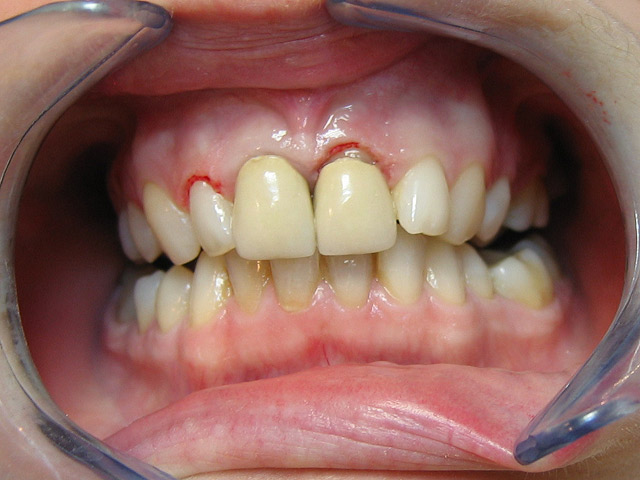 Bez�r�shoz kattintson a k�pre!