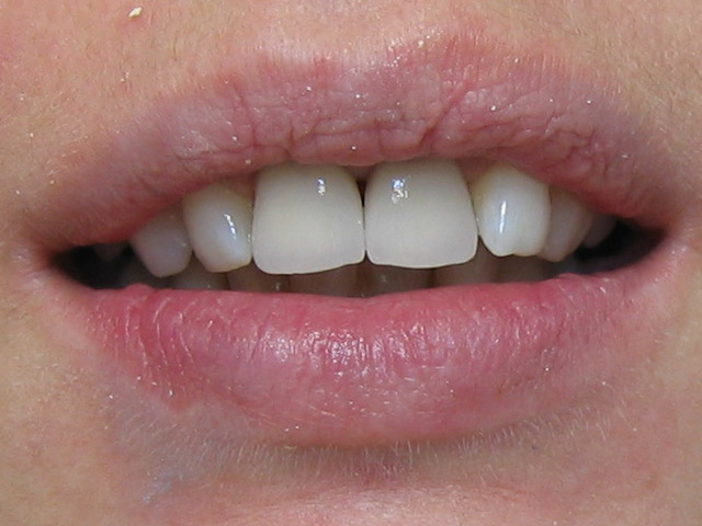 Bez�r�shoz kattintson a k�pre!